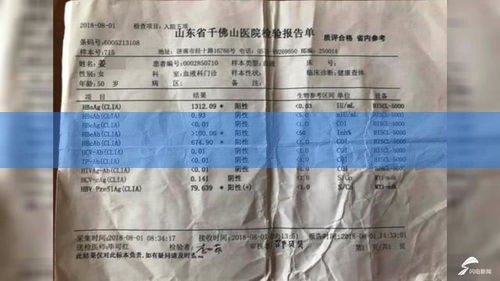 国企招聘体检，乙肝患者被刷几率有多大？