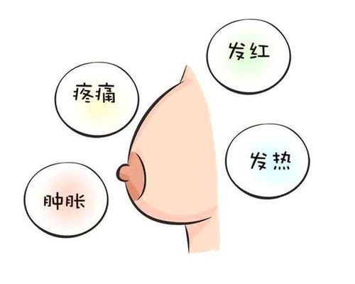 为何乳房疼痛并非涨奶？延误治疗，死亡率竟达100%！