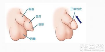 孩子几岁进行包皮手术最合适？探寻最佳割包皮年龄