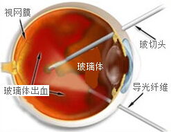 割包切割手术的费用大概是多少？了解价格详情看这里！