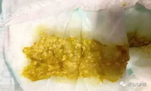 为何挣钱如便秘般艰难，而花钱却似拉稀般迅速？