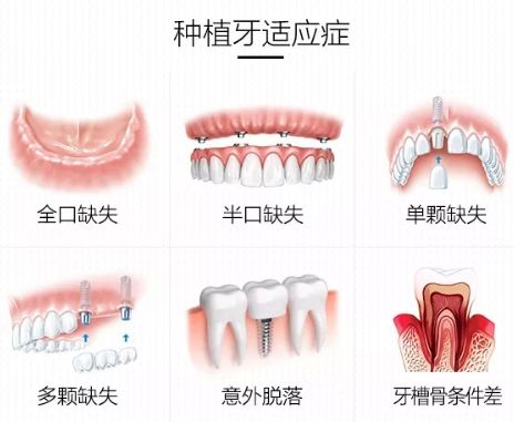 “牙周炎患者能否食用辣椒？牙体牙髓科拔牙有何讲究？”